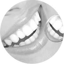 Full Mouth Rehabilitation